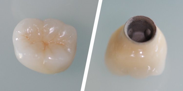 Crown for dental implant