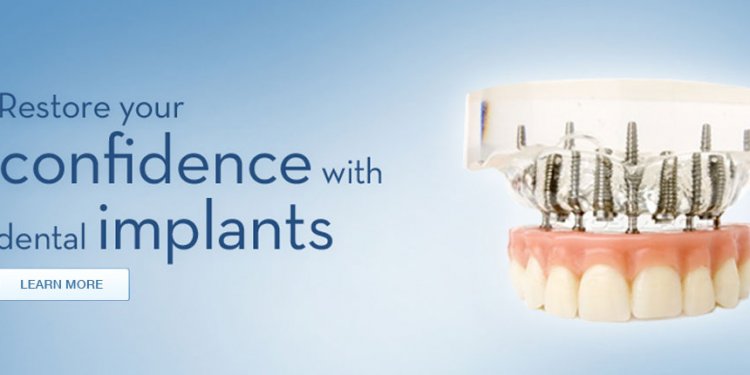 Chicago dental implants