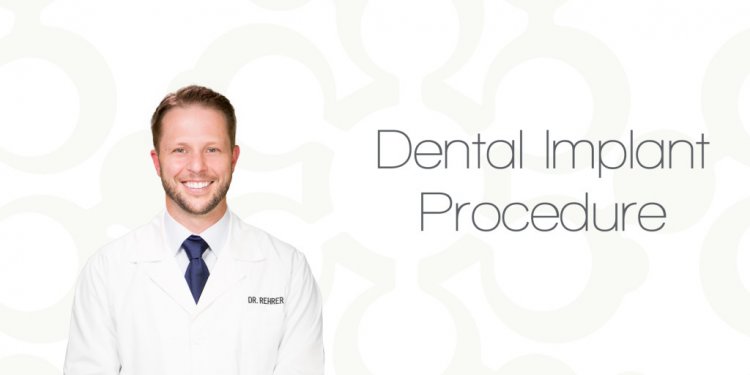 Dental Implant Procedure in