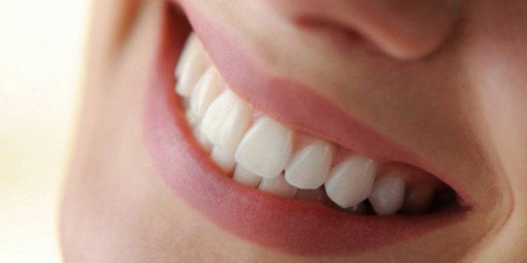 What is Oral Health?