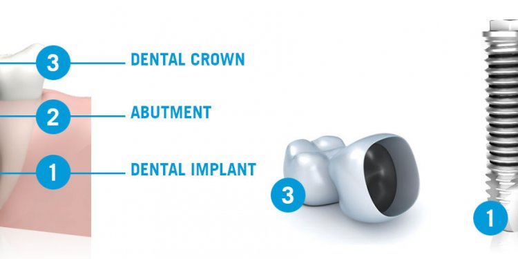 The different components