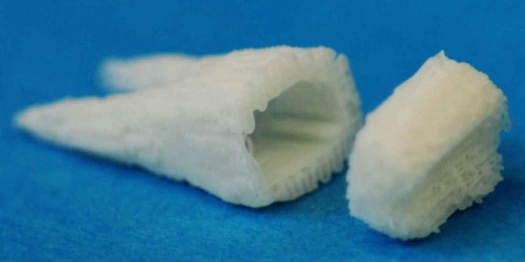Stem-Cell Dental Implants Grow