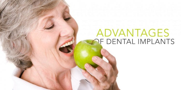 Advantages of Dental Implants