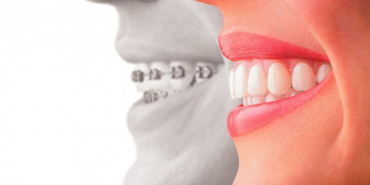 Implants and Cosmetic Dentistry