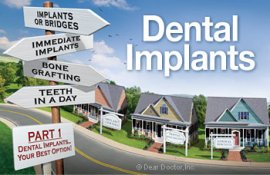 Dental implant options.