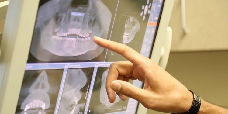 Houston Dental Implants