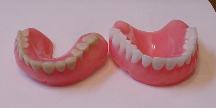 Dental Implant size chart