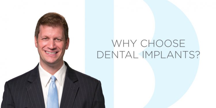 Why Dental implants?