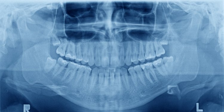 Oral disease Pictures