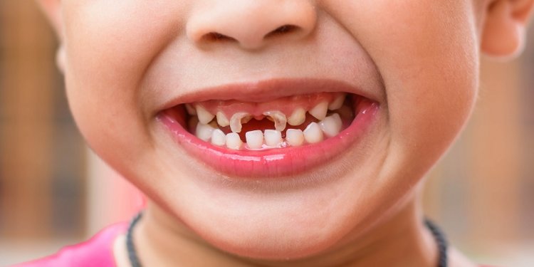 What is Oral Health care?