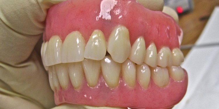 What is Dentures implants?