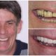 Best Dental Implants