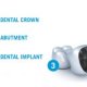 Dental Implant components