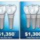 Dental implants cost insurance