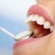 Dental Implants Dentist Reviews