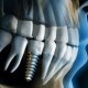 Dentistry that do Dental Implants