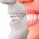 Implants and Cosmetic Dentistry