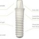 Implants tooth