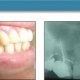 Journal of Implant and Advanced Clinical Dentistry