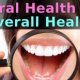 Oral Health overall Health
