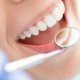 Periodontal disease Implants