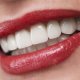 Should I get Dental Implants