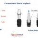 Side effects of Dental Implants