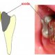 Titanium in Dental Implants