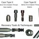 Types of Dental Implant Abutments