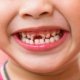 What is Oral Health care?