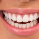 What is poor oral Hygiene?
