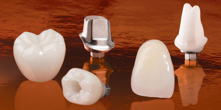 Dental Implants Procedure video