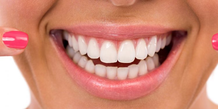 What is poor oral Hygiene?