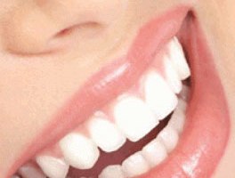 Teeth Whitening