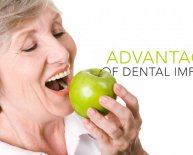 Advantages of Dental Implants