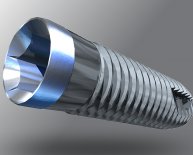 American Dental Implants