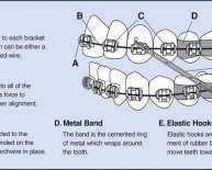 Bad Oral Health effects