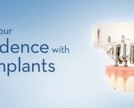 Chicago Dental Implants