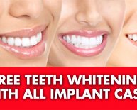 Cosmetic Dental Implants