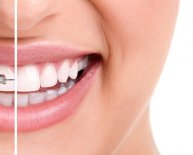 Cosmetic Dentistry Buffalo NY