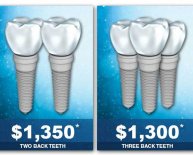 Dental implants cost insurance