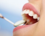 Dental Implants Dentist Reviews