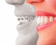 Implants and Cosmetic Dentistry