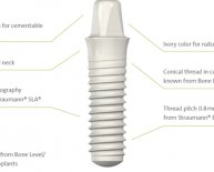 Implants tooth