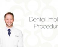 Modern Dental Implants