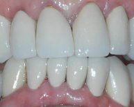 Oral implants and Reconstructive Dentistry