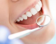 Periodontal disease Implants