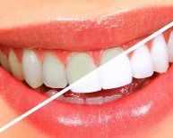 What is good Oral health?