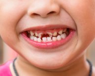 What is Oral Health care?